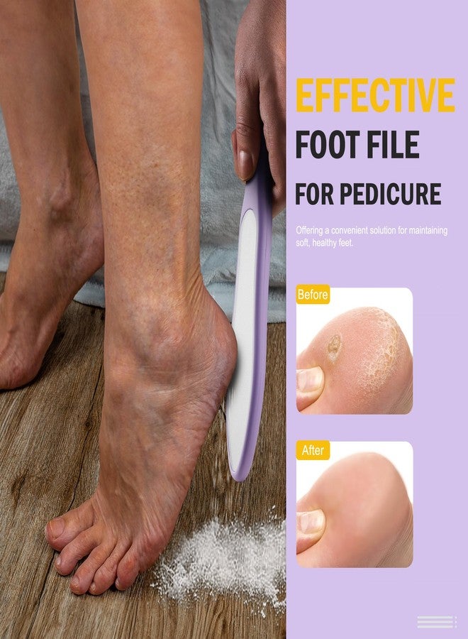 FVION Double-Sided Nano Glass Foot File for Callus Remover - Highly Effective Hard and Dead Skin Remover for Cracked Heels and Dry Skin (Purple) - Image 3